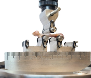 Precision Dermal Remodeling: The Biophysical Mechanics and Engineering Architecture of Automated Percutaneous Collagen Induction